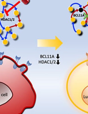 Connecting the Dots to Find New Treatments for Breast Cancer​