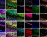 PICASSO Technique Drives Biological Molecules into Technicolor​