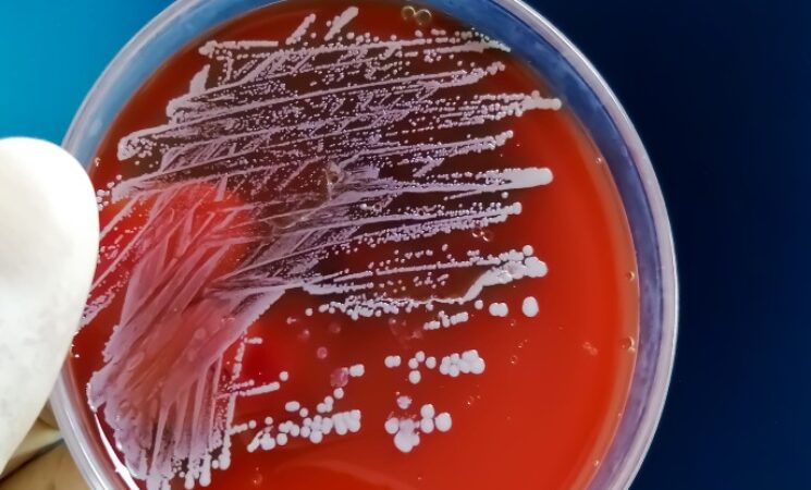세균 감염에 대한 유전적 소인 연구
