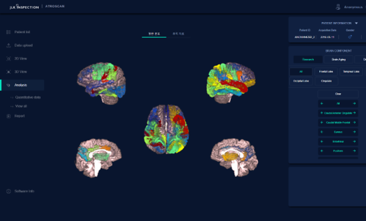 ​JLK's AI brain image analysis solution wins approval from Thai health department